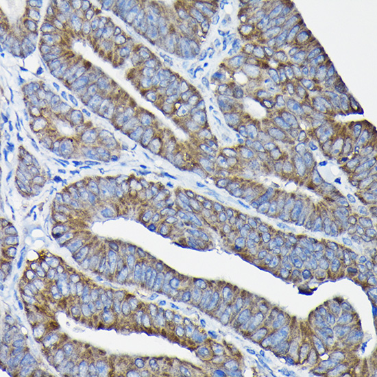 Nesprin 1 Rabbit polyclonal antibody
