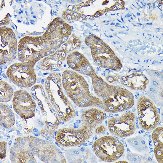 Nesprin 1 Rabbit polyclonal antibody