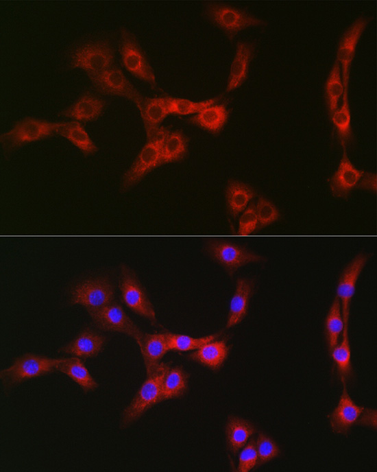 Nesprin 1 Rabbit polyclonal antibody