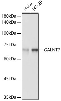 GALNT7 Rabbit polyclonal antibody
