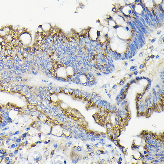 GALNT7 Rabbit polyclonal antibody
