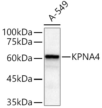 KPNA4 Rabbit polyclonal antibody
