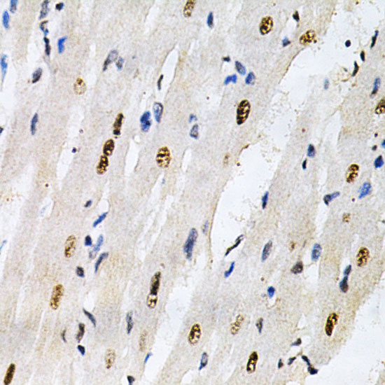 KPNA4 Rabbit polyclonal antibody