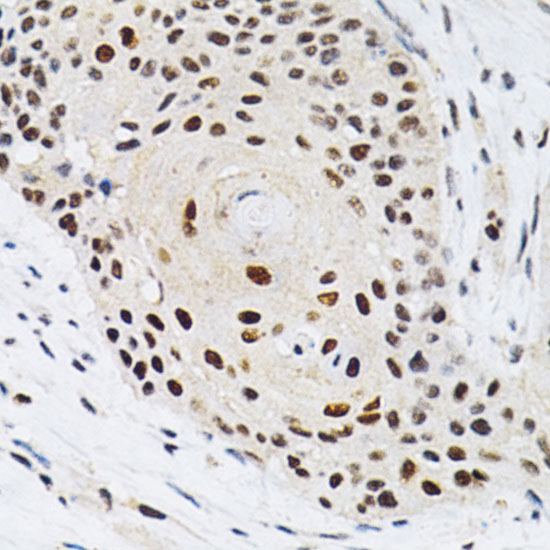 KPNA4 Rabbit polyclonal antibody