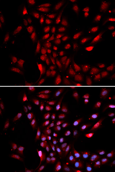 KPNA4 Rabbit polyclonal antibody