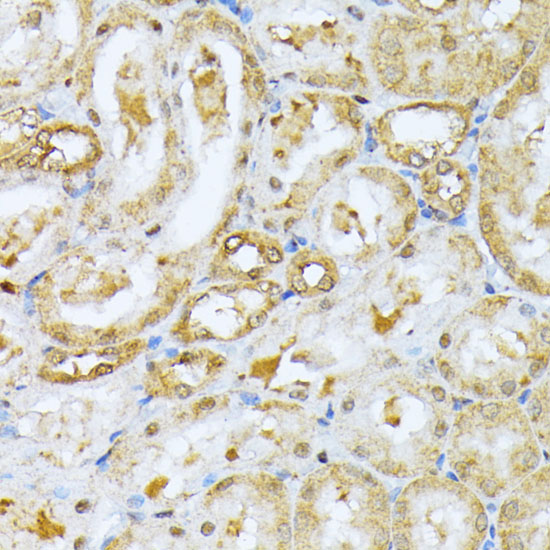 RPS27A Rabbit polyclonal antibody