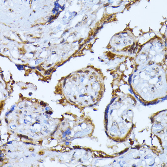 RPS27A Rabbit polyclonal antibody