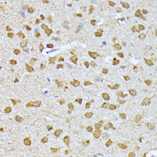 RPS27A Rabbit polyclonal antibody