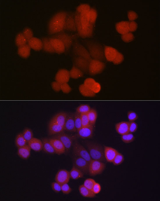 RPS27A Rabbit polyclonal antibody