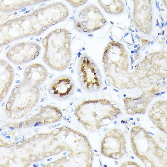 SLC5A2 Rabbit polyclonal antibody