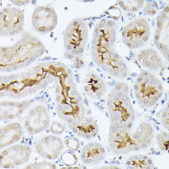 SLC5A2 Rabbit polyclonal antibody