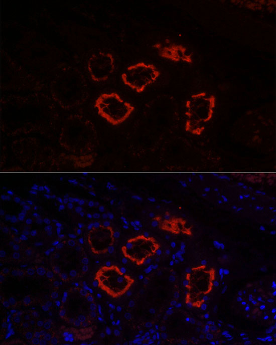 SLC5A2 Rabbit polyclonal antibody