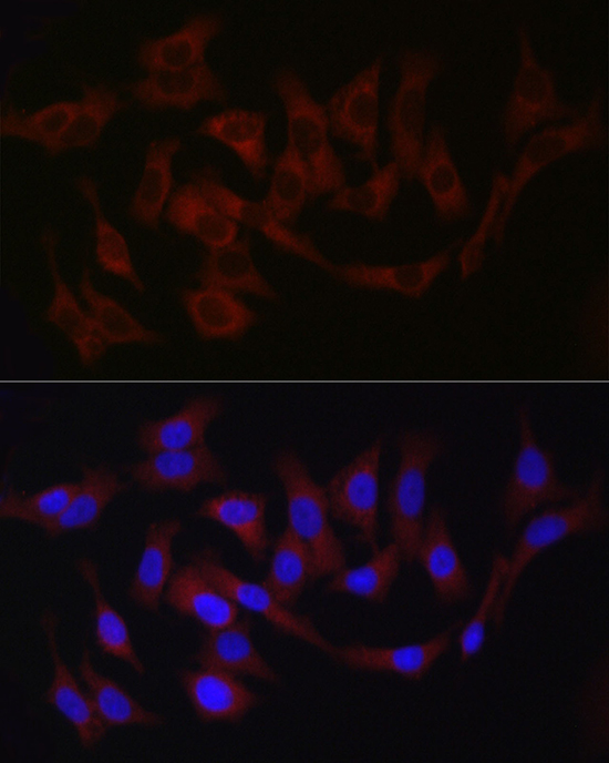Fam221a Rabbit polyclonal antibody