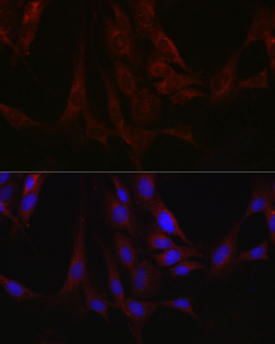Fam221a Rabbit polyclonal antibody