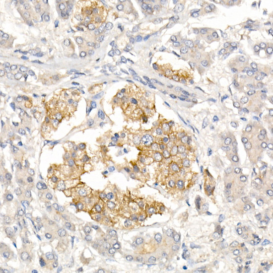 CD99 Rabbit polyclonal antibody
