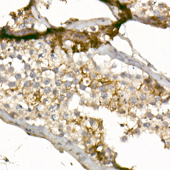 CD99 Rabbit polyclonal antibody