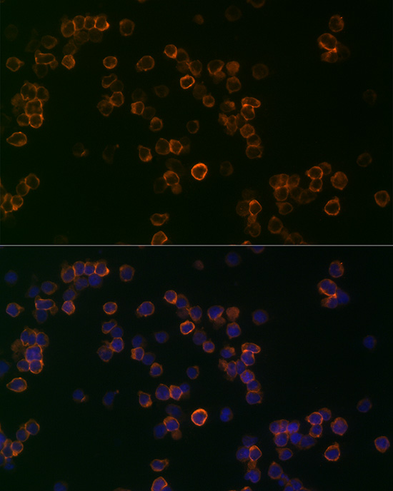 CD99 Rabbit polyclonal antibody