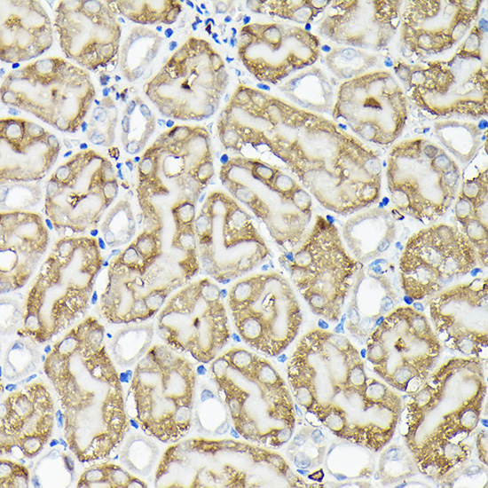 RPS6KA1/RPS6KA2/RPS6KA3 Rabbit polyclonal antibody