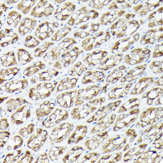 RPS6KA1/RPS6KA2/RPS6KA3 Rabbit polyclonal antibody