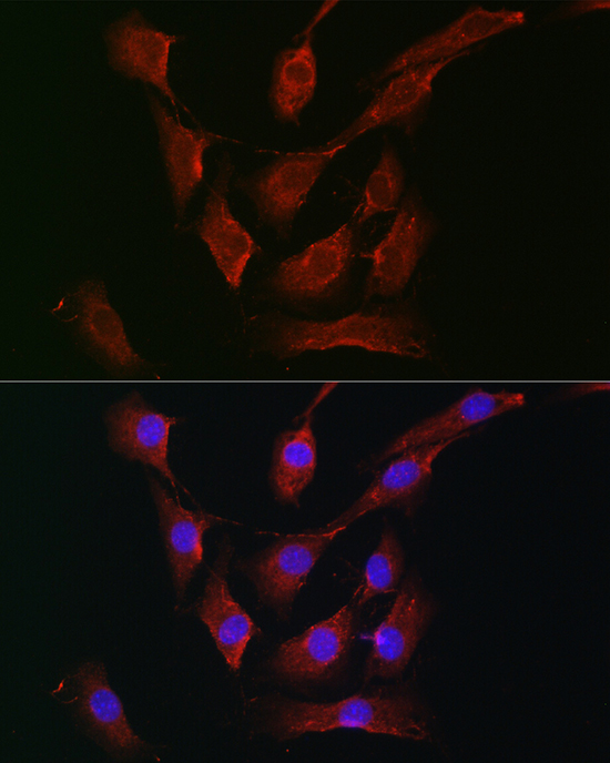 RPS6KA1/RPS6KA2/RPS6KA3 Rabbit polyclonal antibody
