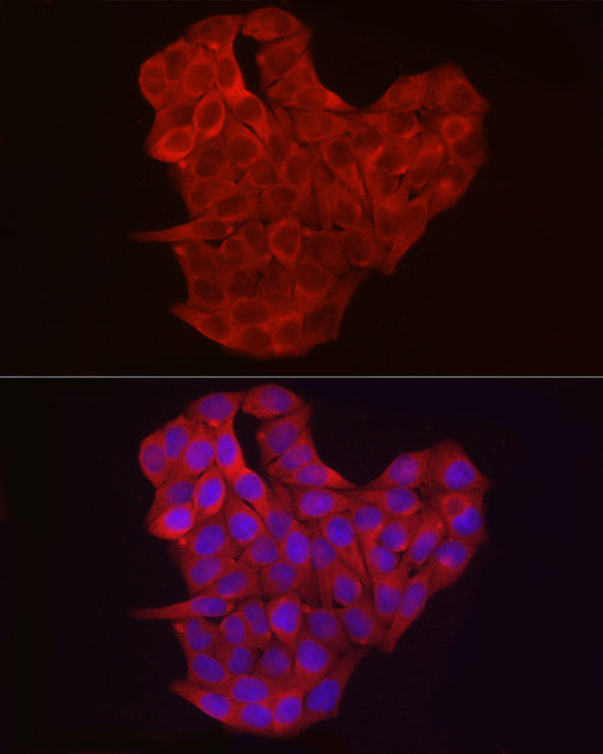 EXT1 Rabbit polyclonal antibody