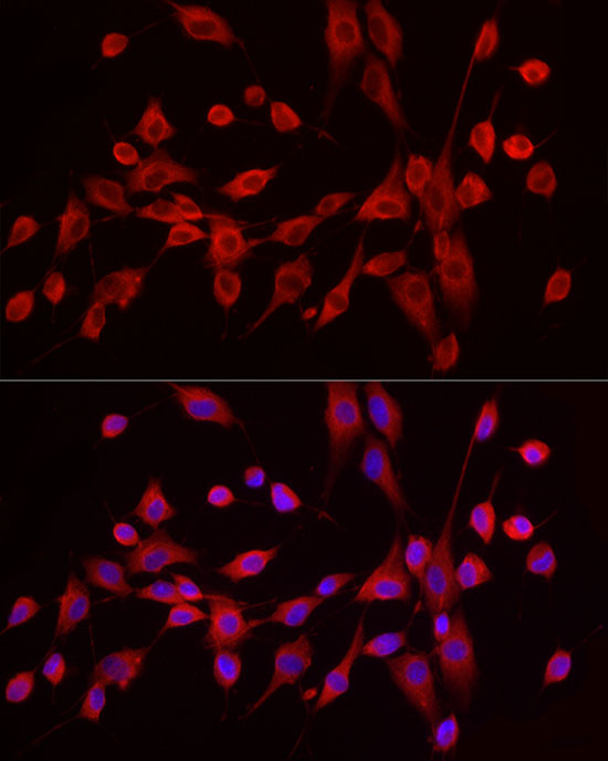 EXT1 Rabbit polyclonal antibody
