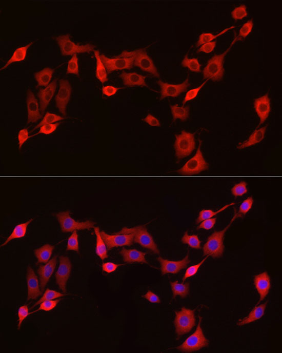 EXT1 Rabbit polyclonal antibody