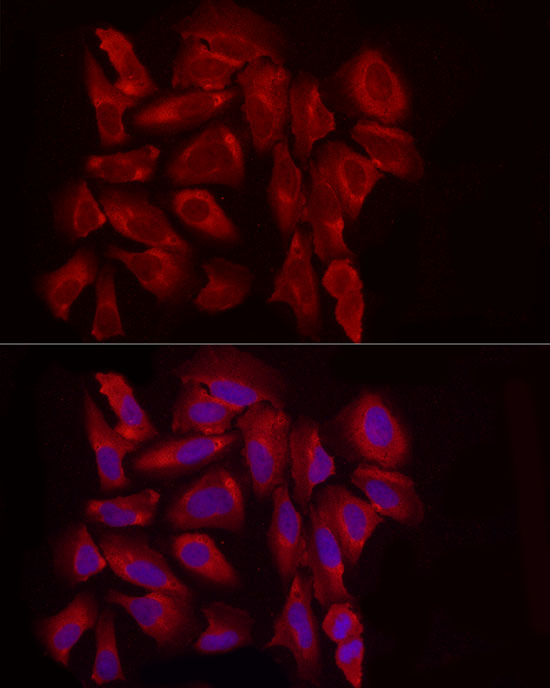 EXT1 Rabbit polyclonal antibody