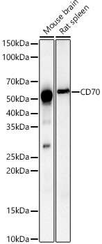 CD70 Rabbit polyclonal antibody