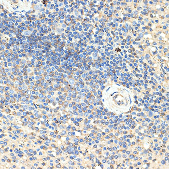 CD70 Rabbit polyclonal antibody
