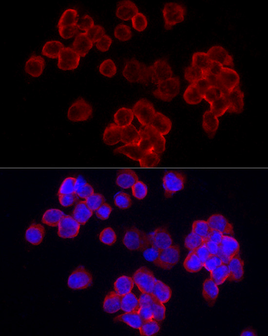 CD70 Rabbit polyclonal antibody