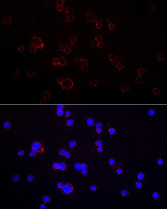 CD70 Rabbit polyclonal antibody