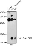 Western blot - SARS-CoV-2 ORF6 Rabbit pAb (A20324)
