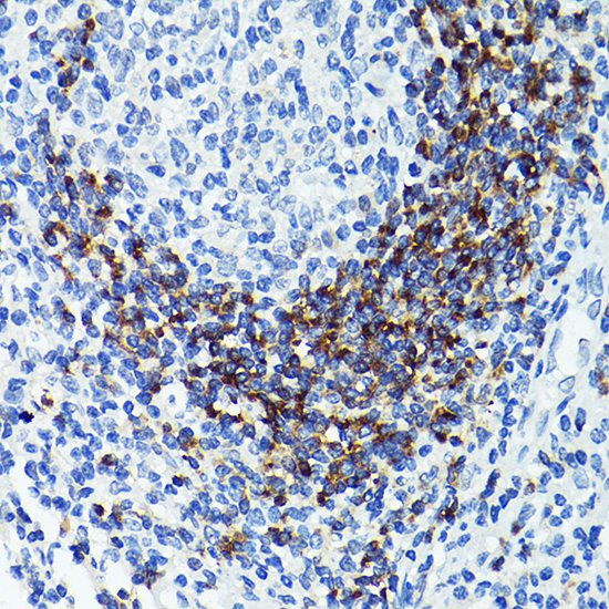 CD79B Rabbit polyclonal antibody