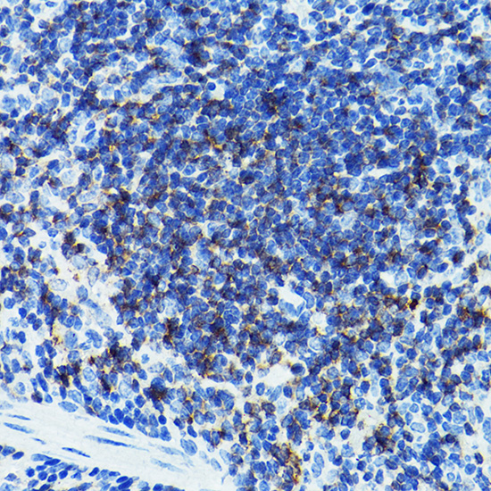 CD79B Rabbit polyclonal antibody