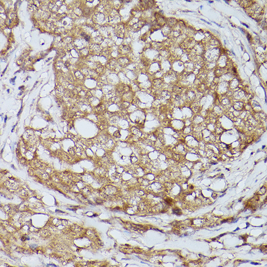 Slc39a11 Rabbit polyclonal antibody