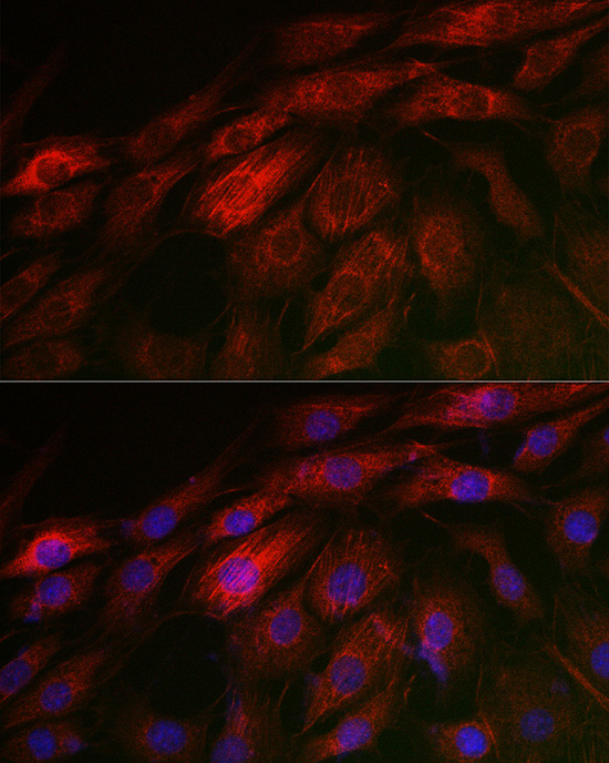 CNN3 Rabbit polyclonal antibody