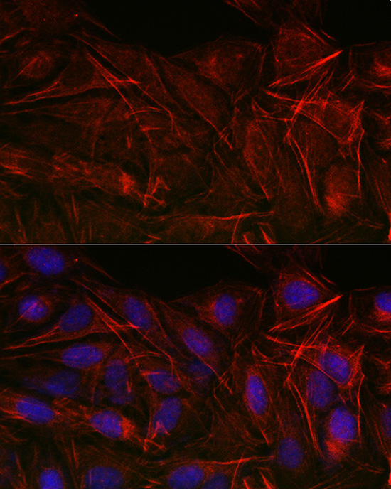 CNN3 Rabbit polyclonal antibody