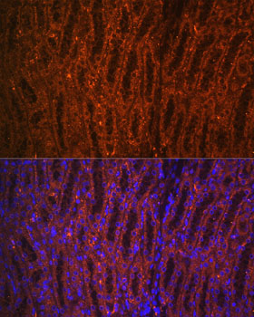 PCK1 Rabbit polyclonal antibody