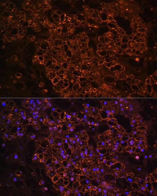 PCK1 Rabbit polyclonal antibody