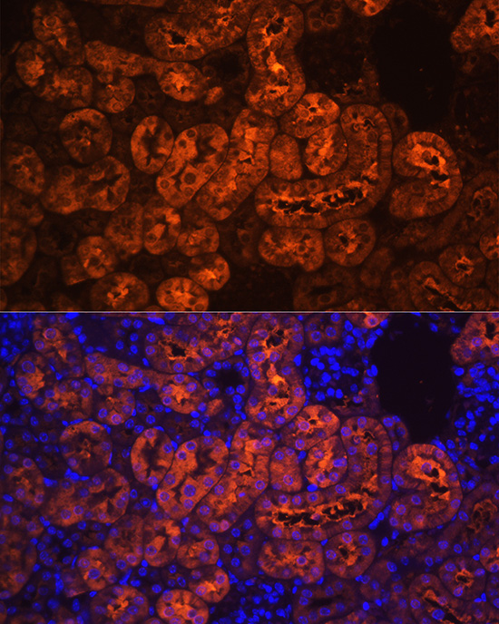 PCK1 Rabbit polyclonal antibody