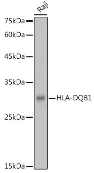 HLA-DQB1 Rabbit polyclonal antibody
