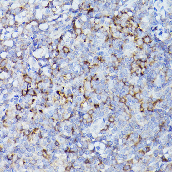 HLA-DQB1 Rabbit polyclonal antibody