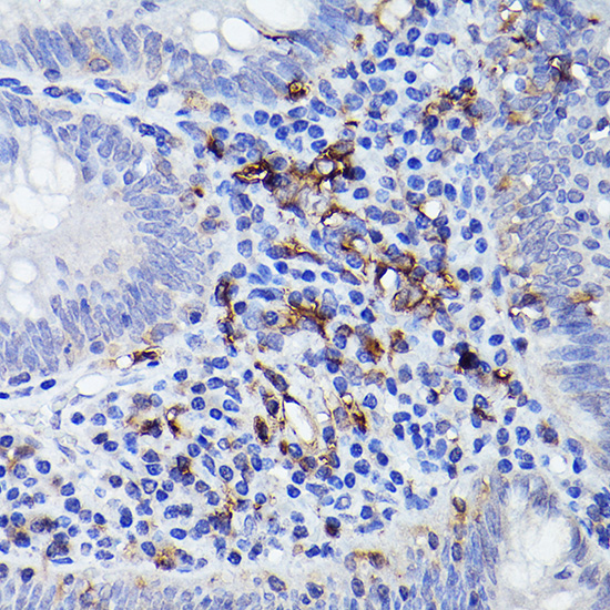 HLA-DQB1 Rabbit polyclonal antibody