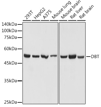 DBT Rabbit polyclonal antibody