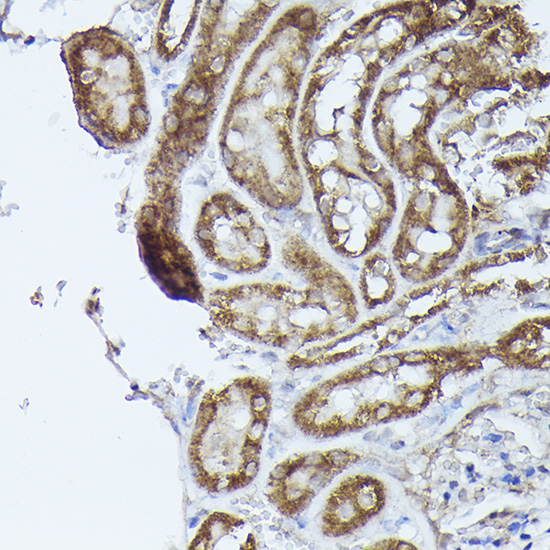 DBT Rabbit polyclonal antibody