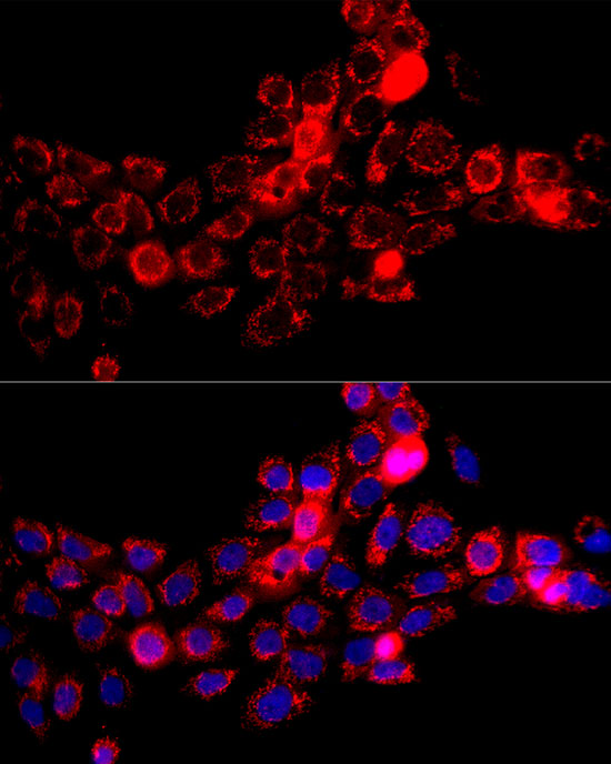 DBT Rabbit polyclonal antibody