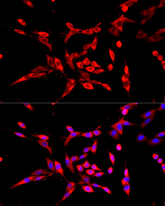 DBT Rabbit polyclonal antibody