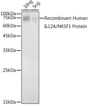 IL12A Rabbit polyclonal antibody