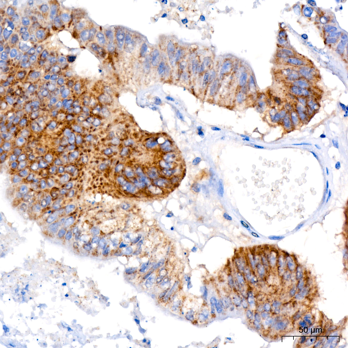 ACSL4 Rabbit monoclonal antibody